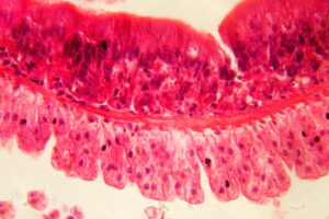 What Does a Worm Look Like Under a Microscope? Tips, Facts, & FAQ