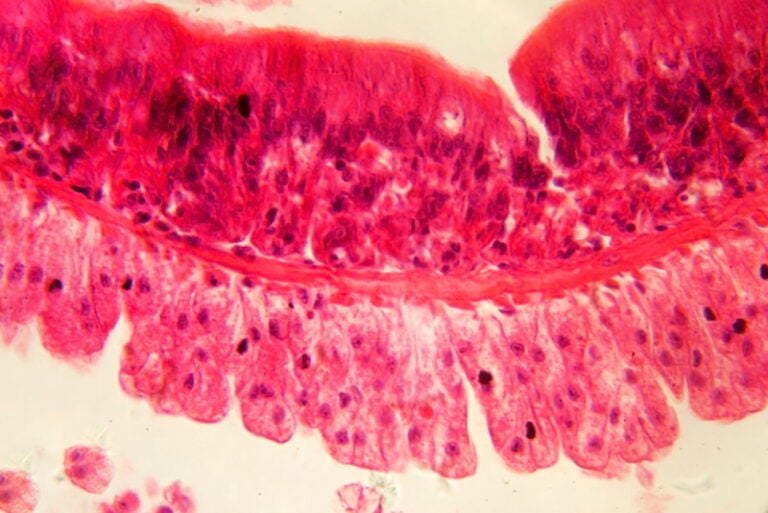 What Does a Worm Look Like Under a Microscope? Tips, Facts, & FAQ