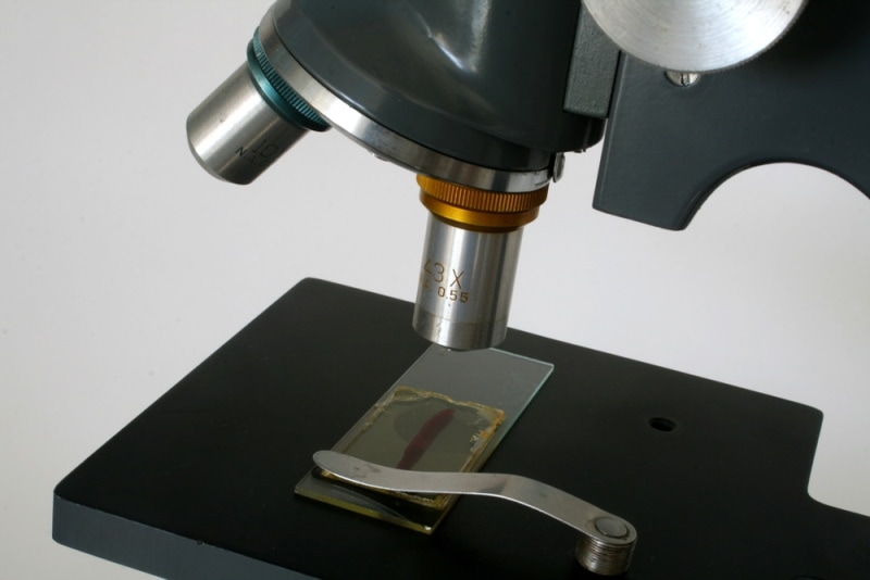 microscope with leech on slide