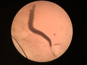 What Does a Worm Look Like Under a Microscope? The Surprising Answer ...