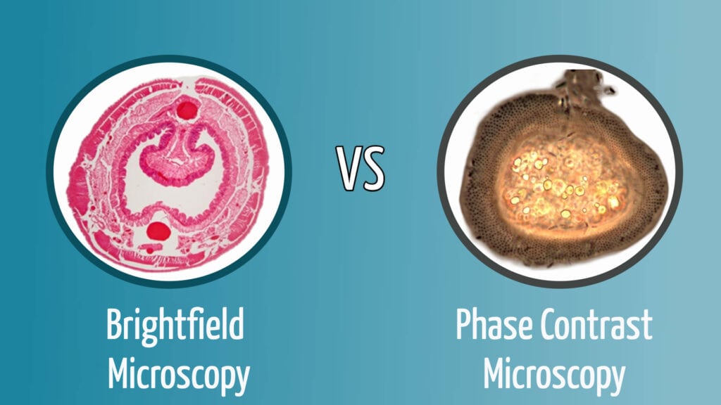 Brightfield vs Phase Contrast Microscopy (featured)